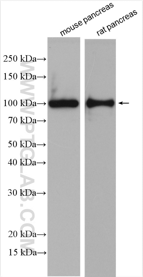 Western Blot (WB) analysis of various lysates using ALDH1L2 Polyclonal antibody (21391-1-AP)
