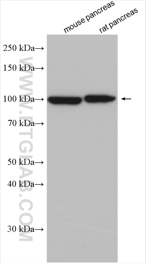 Western Blot (WB) analysis of various lysates using ALDH1L2 Polyclonal antibody (21391-1-AP)