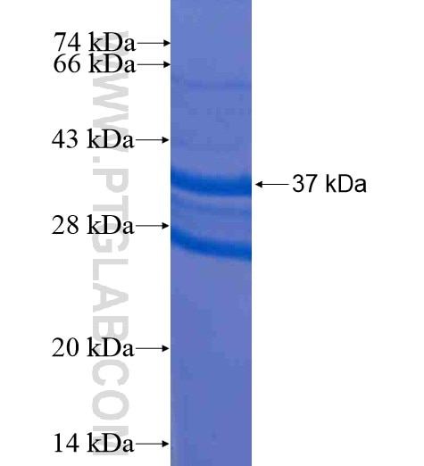 ALDH1L2 fusion protein Ag16046 SDS-PAGE