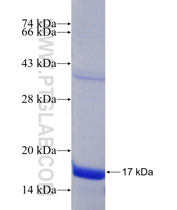 ALDH1L2 fusion protein Ag17340 SDS-PAGE