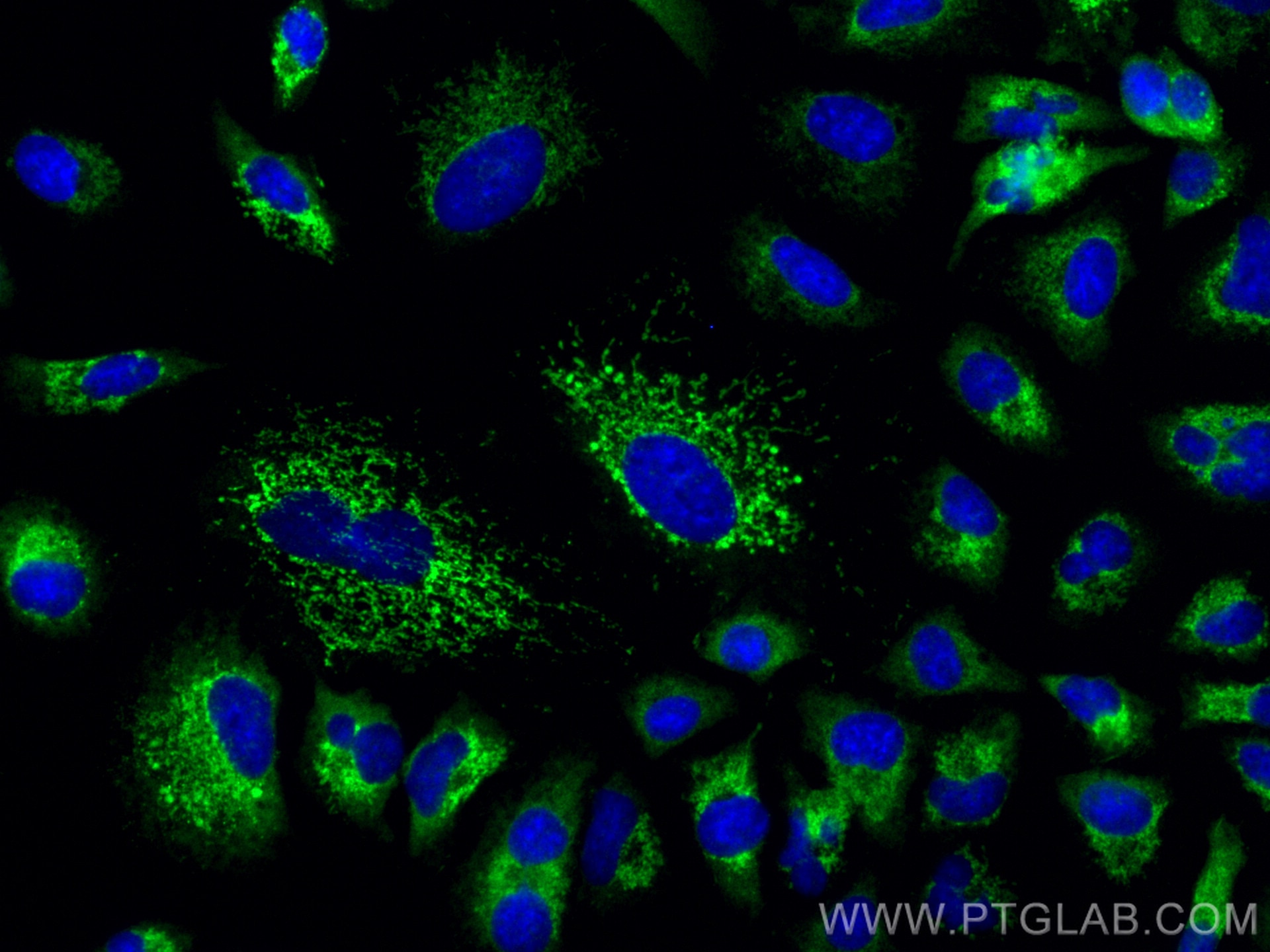 Immunofluorescence (IF) / fluorescent staining of A549 cells using ALDH2 Polyclonal antibody (15310-1-AP)