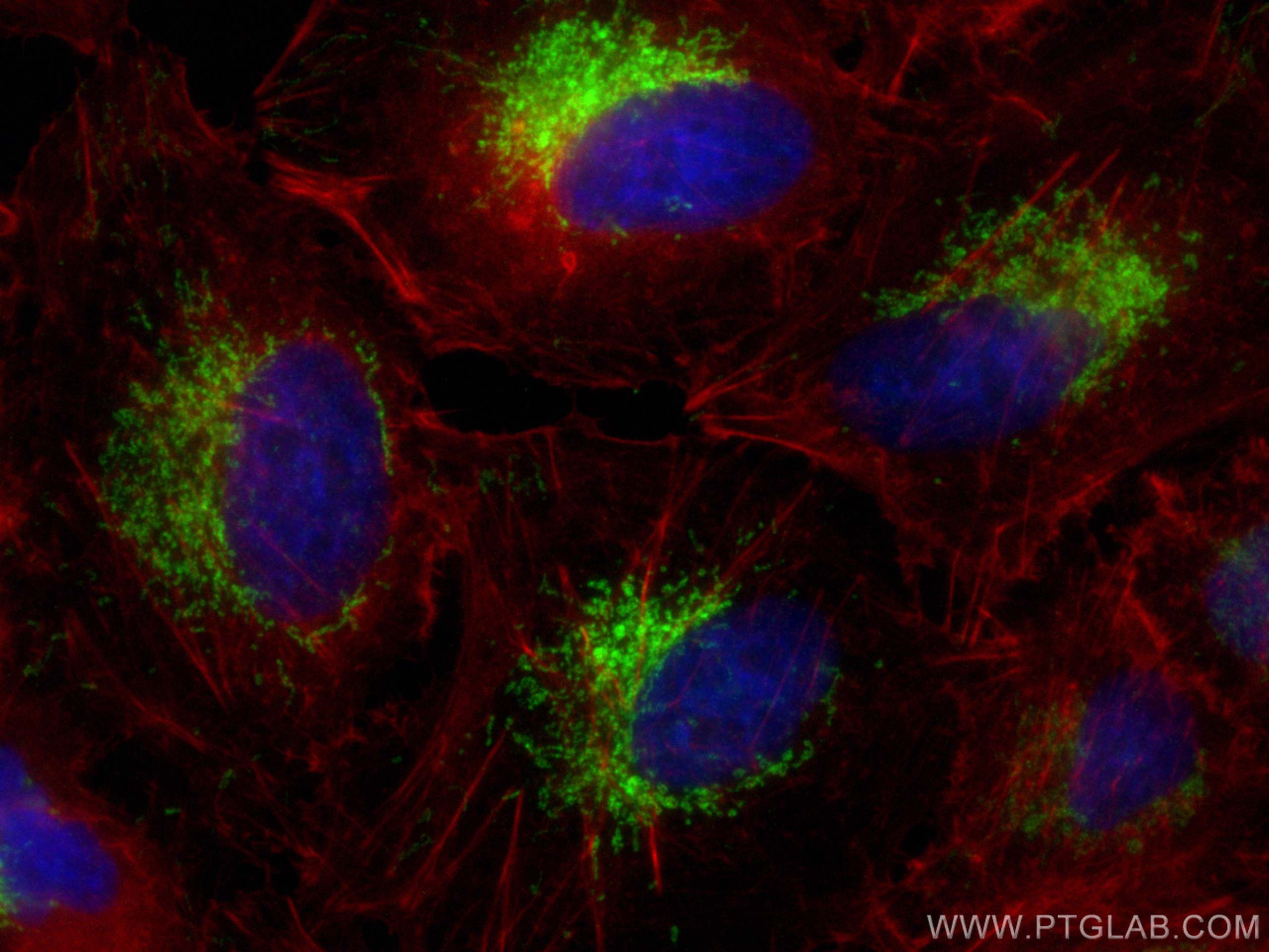 Immunofluorescence (IF) / fluorescent staining of A549 cells using ALDH2 Polyclonal antibody (15310-1-AP)