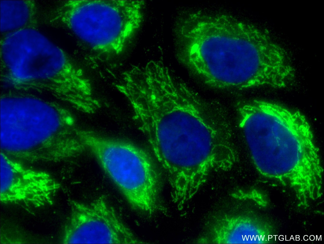 Immunofluorescence (IF) / fluorescent staining of A549 cells using ALDH2 Polyclonal antibody (15310-1-AP)