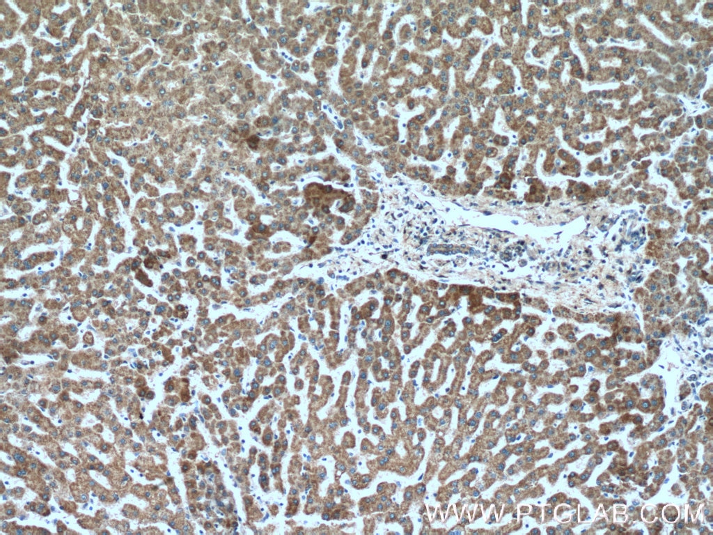 Immunohistochemistry (IHC) staining of human liver tissue using ALDH2 Polyclonal antibody (15310-1-AP)