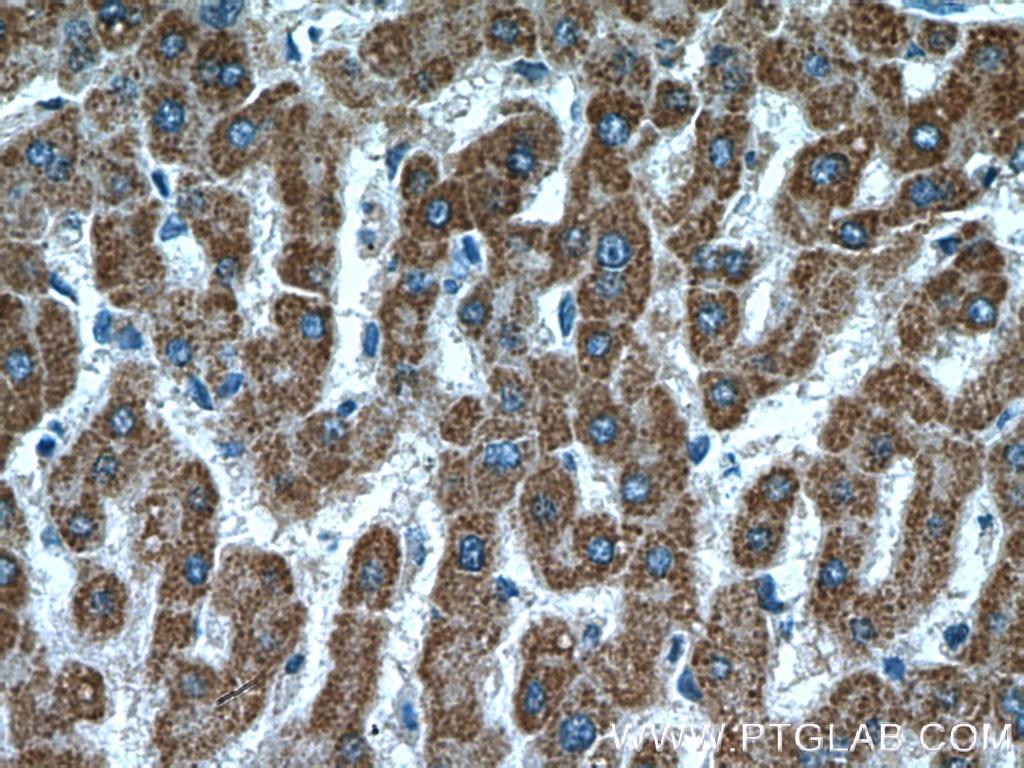 Immunohistochemistry (IHC) staining of human liver tissue using ALDH2 Polyclonal antibody (15310-1-AP)