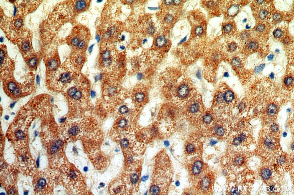 ALDH2 Polyclonal antibody