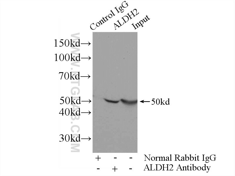 Immunoprecipitation (IP) experiment of mouse lung tissue using ALDH2 Polyclonal antibody (15310-1-AP)