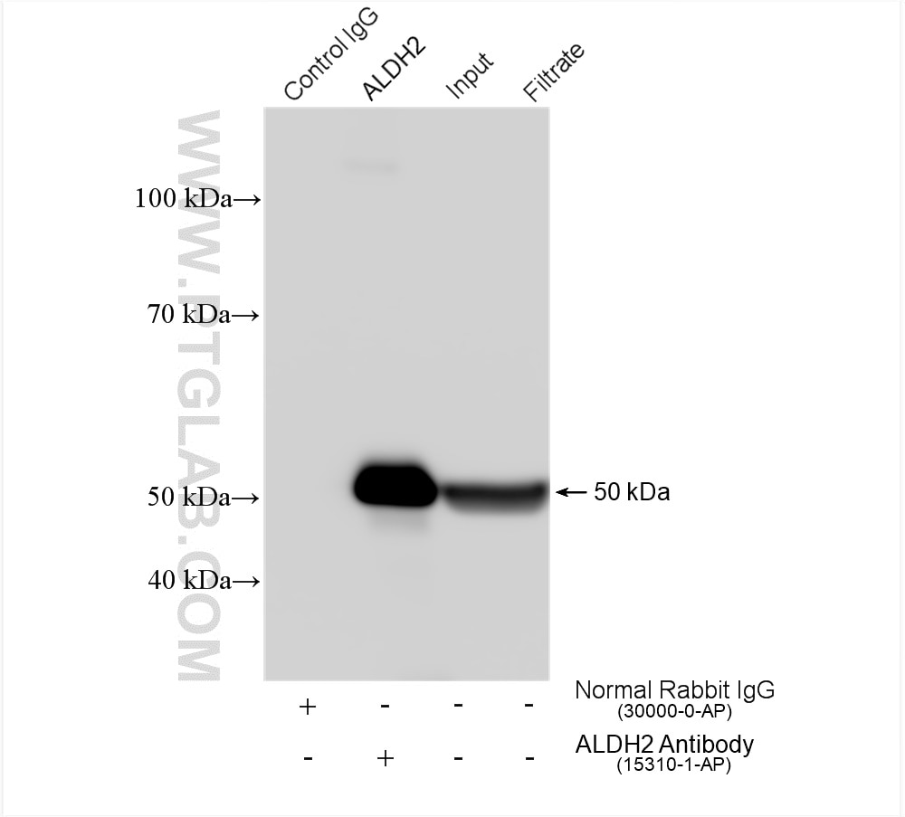 Immunoprecipitation (IP) experiment of HepG2 cells using ALDH2 Polyclonal antibody (15310-1-AP)