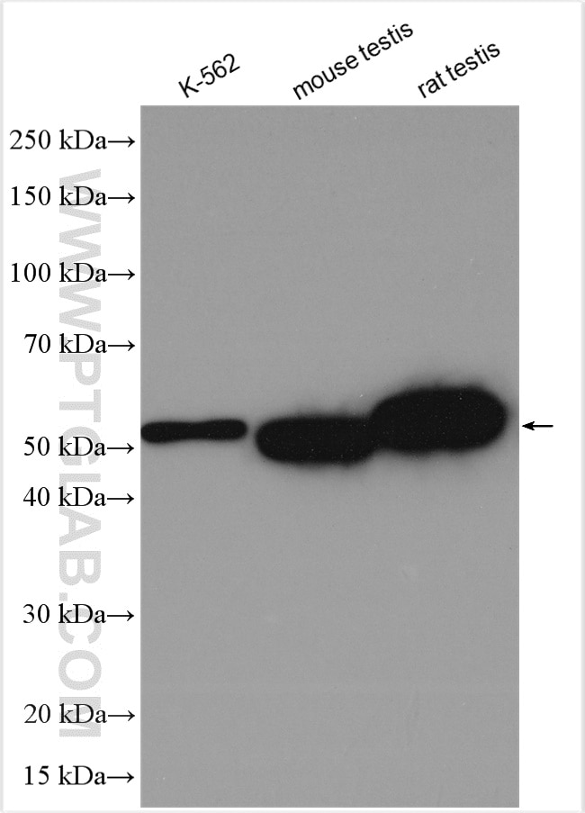 Western Blot (WB) analysis of various lysates using ALDH2 Polyclonal antibody (15310-1-AP)