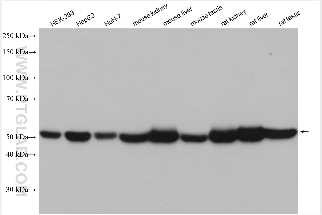 Western Blot (WB) analysis of various lysates using ALDH2 Polyclonal antibody (15310-1-AP)