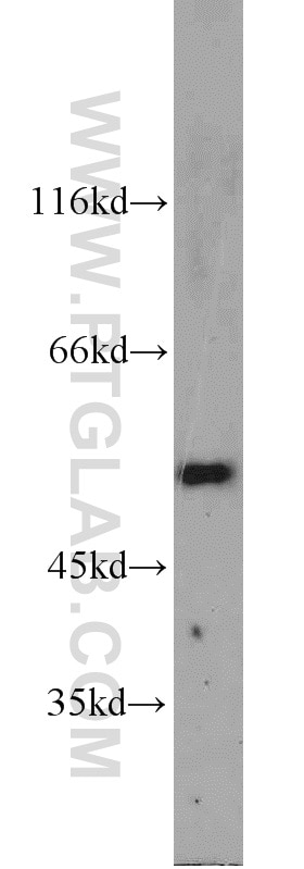 Western Blot (WB) analysis of human heart tissue using ALDH2 Polyclonal antibody (15310-1-AP)