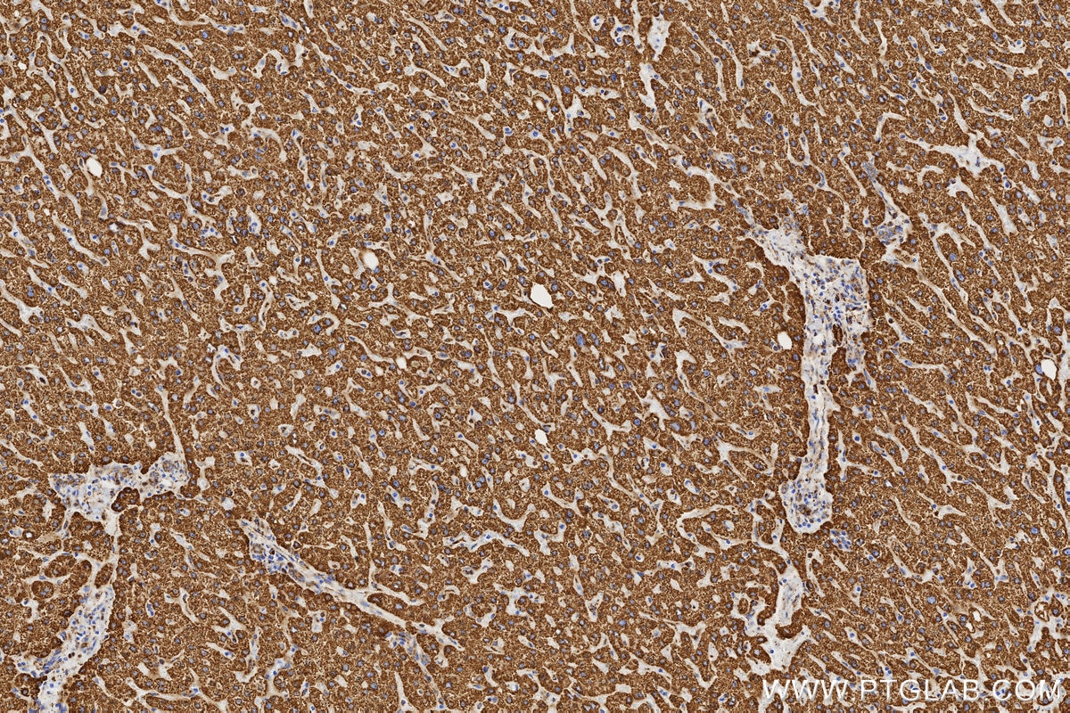 IHC staining of human liver using 86429-5-RR Immunohistochemistry (IHC) staining of human liver tissue using ALDH2 Recombinant monoclonal antibody (86429-5-RR)