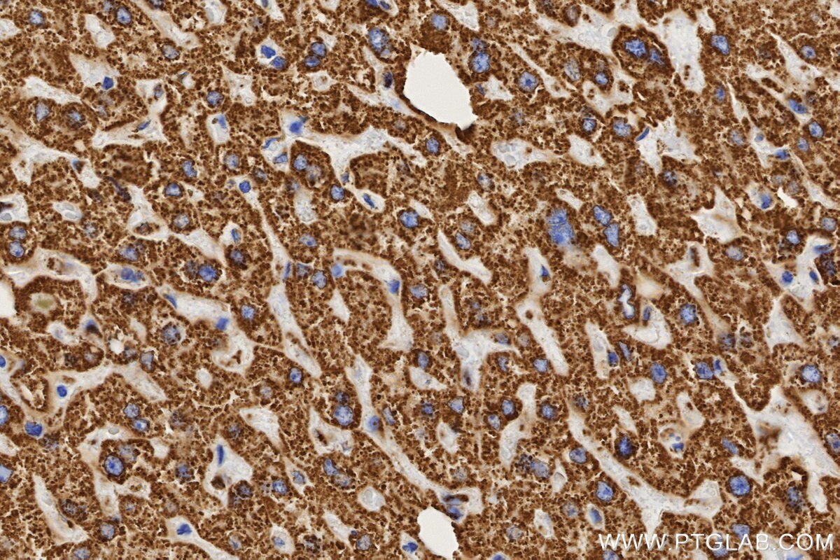 IHC staining of human liver using 86429-5-RR Immunohistochemistry (IHC) staining of human liver tissue using ALDH2 Recombinant monoclonal antibody (86429-5-RR)