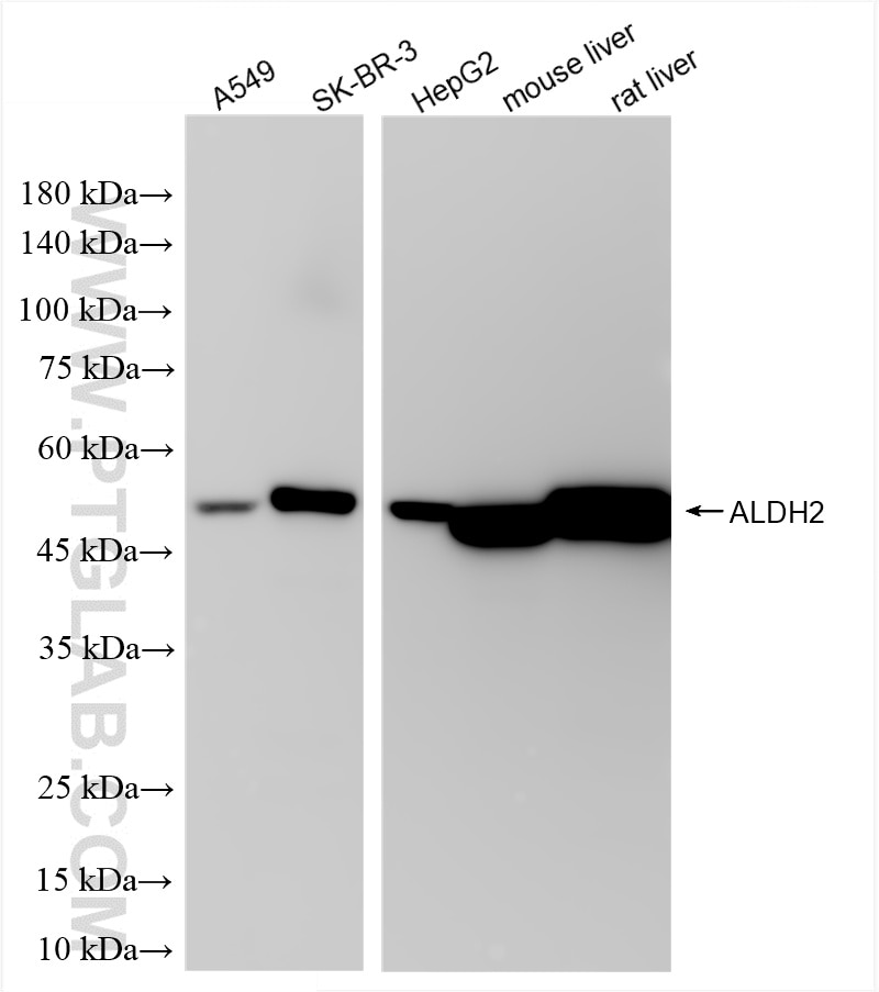 Western Blot (WB) analysis of various lysates using ALDH2 Recombinant antibody (86429-5-RR)
