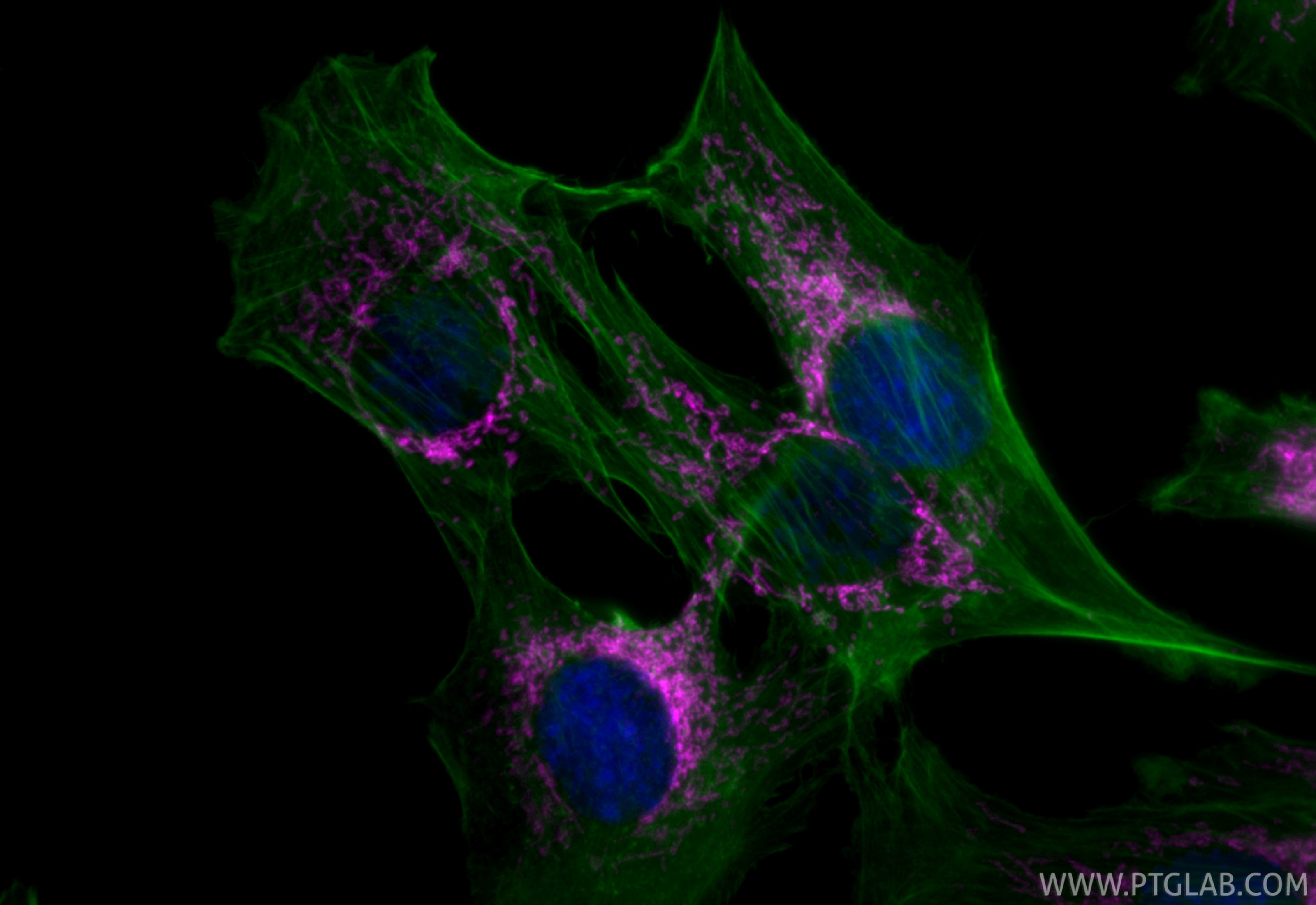 Immunofluorescent analysis of (4% PFA) fixed C2C12 cells using CoraLite® Plus 647 ALDH2 antibody (CL647-86429-5, Clone: 251287E9 ) at dilution of 1:200, CL488-phalloidin (green). Immunofluorescence (IF) / fluorescent staining of C2C12 cells using CoraLite® Plus 647-conjugated ALDH2 Recombinant mo (CL647-86429-5)