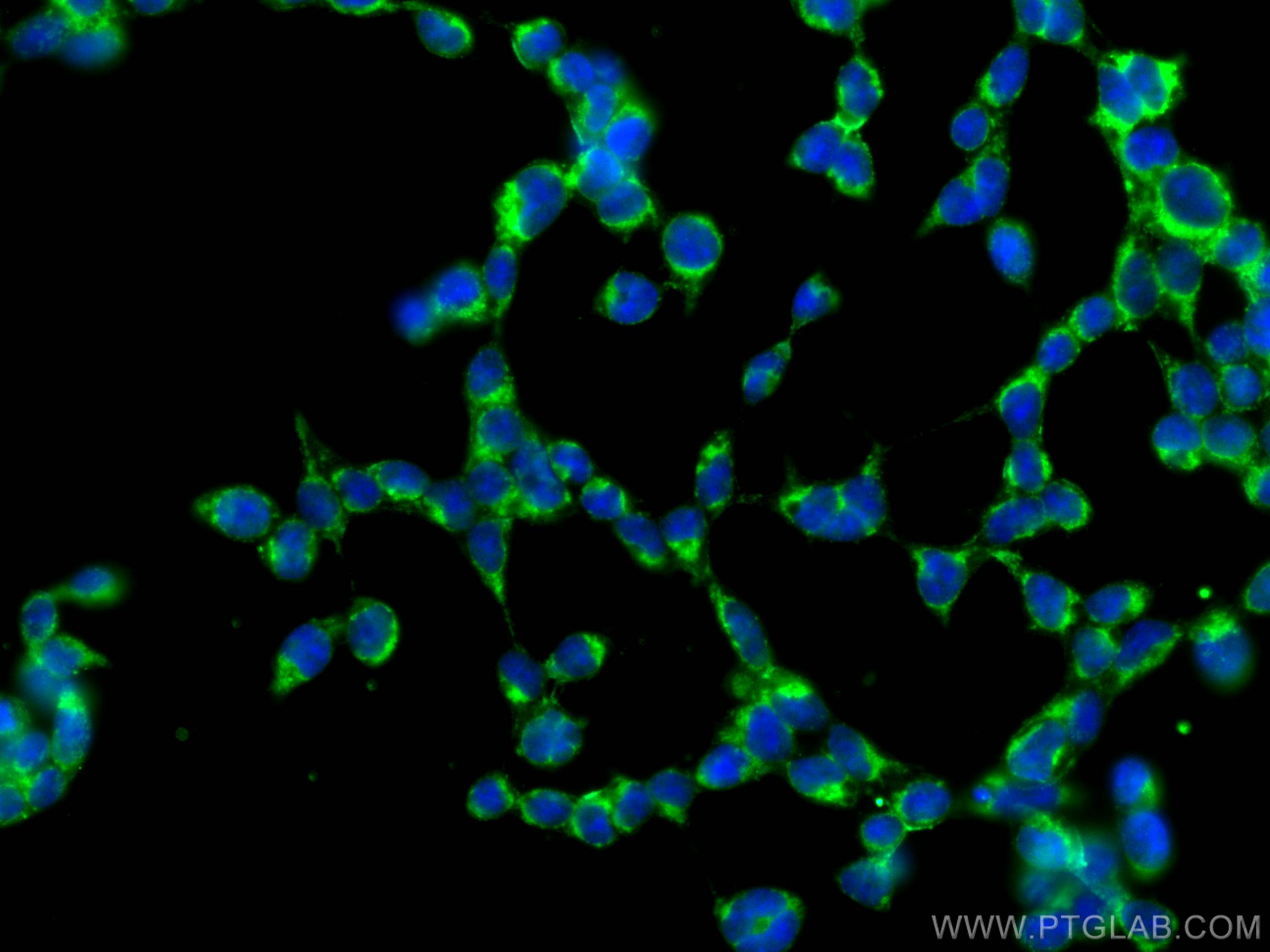 Immunofluorescence (IF) / fluorescent staining of HEK-293T cells using ALDH3A1 Polyclonal antibody (15578-1-AP)