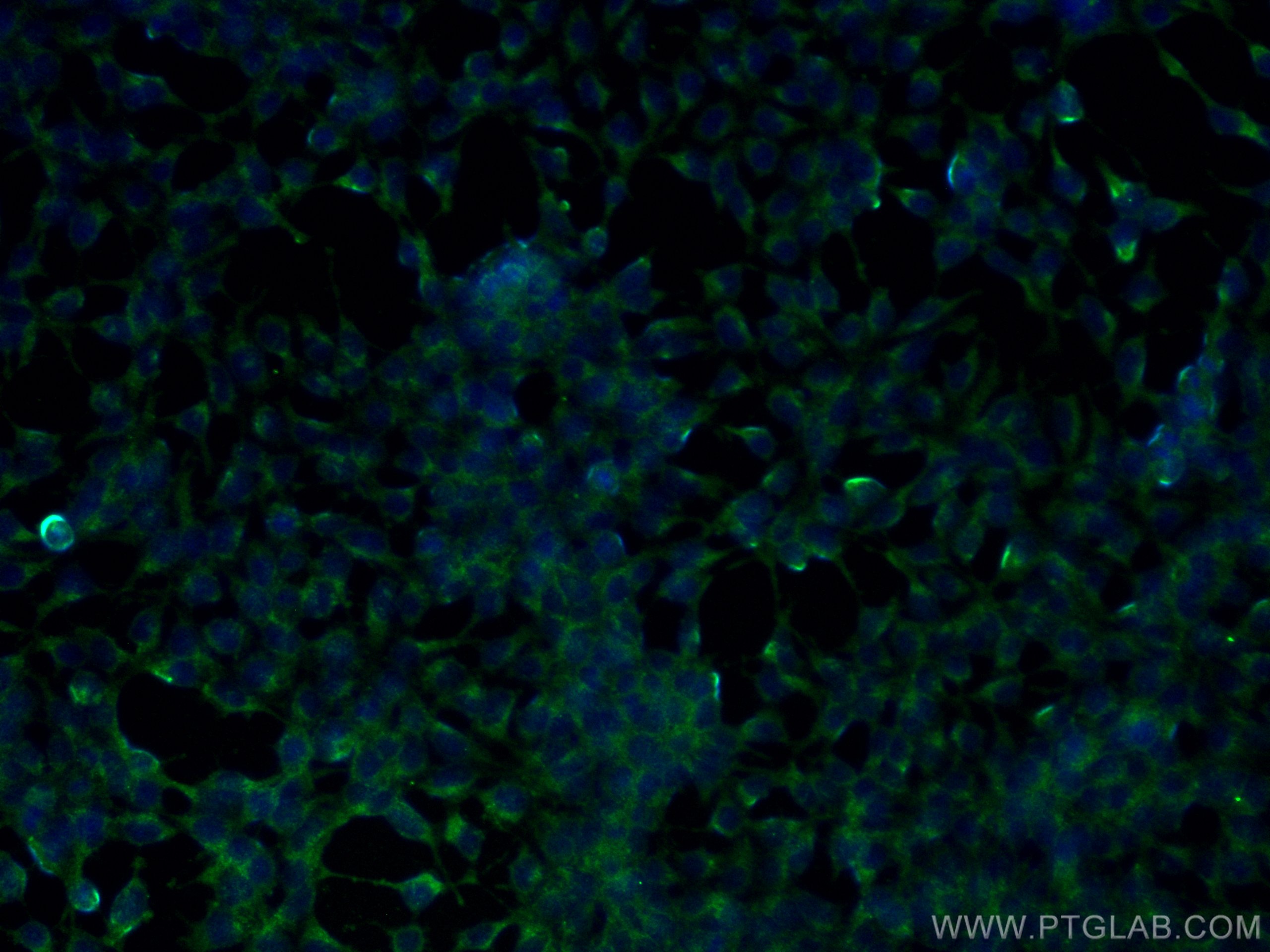Immunofluorescence (IF) / fluorescent staining of HEK-293 cells using ALDH3A1 Monoclonal antibody (68036-1-Ig)