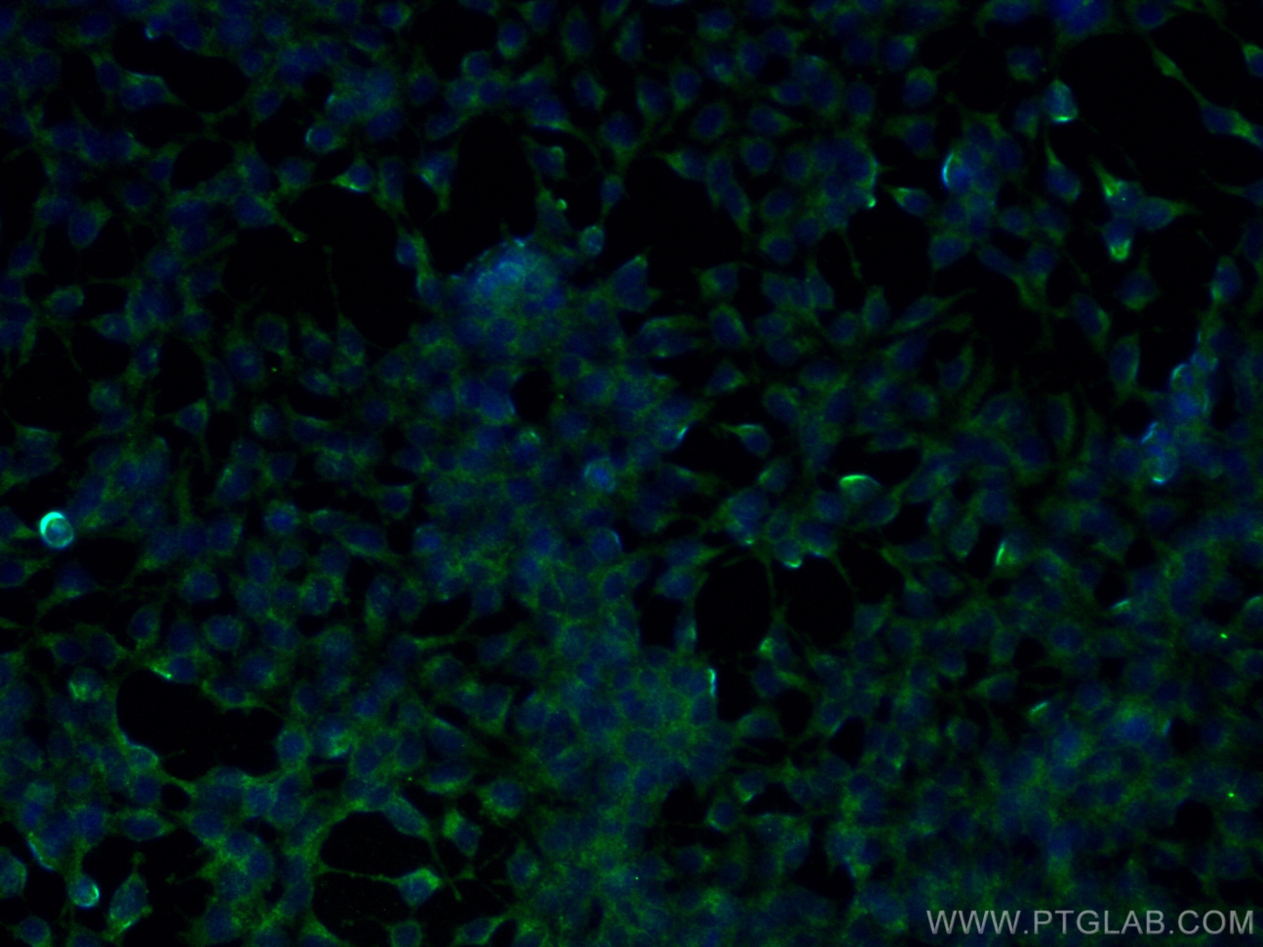 Immunofluorescence (IF) / fluorescent staining of HEK-293 cells using ALDH3A1 Monoclonal antibody (68036-1-Ig)