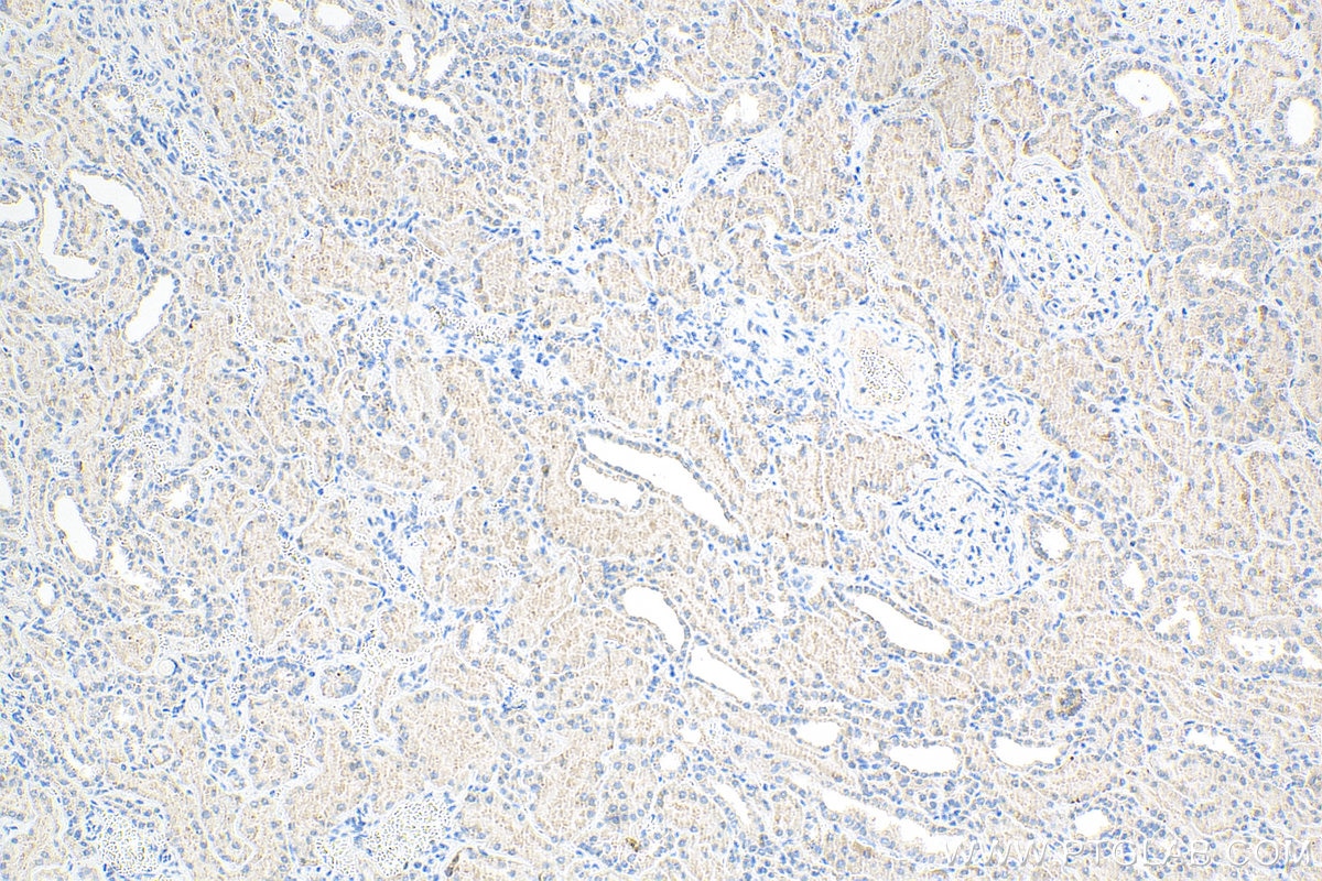 Immunohistochemistry (IHC) staining of human kidney tissue using ALDH3A1 Monoclonal antibody (68036-1-Ig)