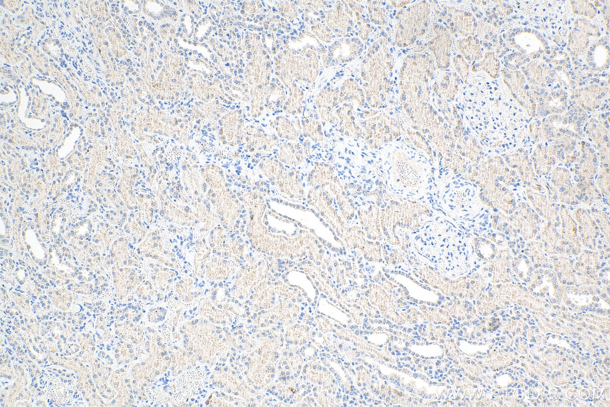 IHC staining of human kidney using 68036-1-Ig