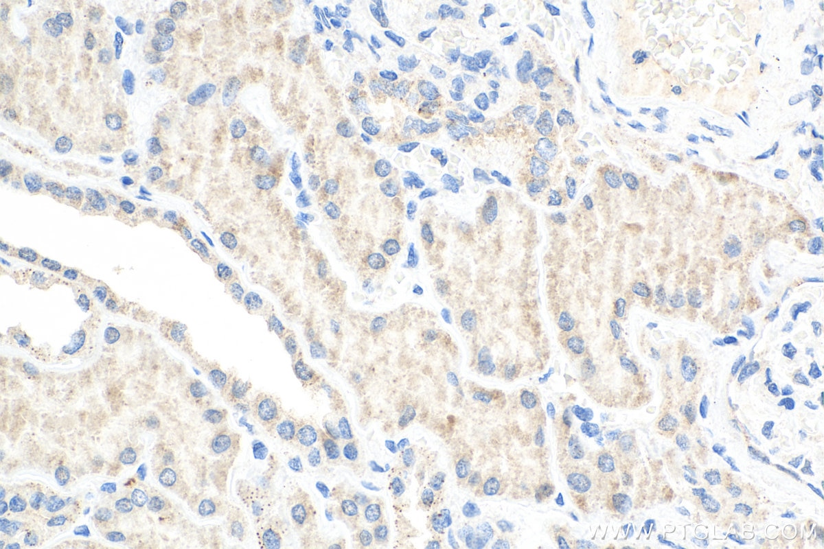 Immunohistochemistry (IHC) staining of human kidney tissue using ALDH3A1 Monoclonal antibody (68036-1-Ig)