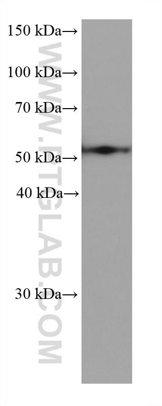 Western Blot (WB) analysis of LNCaP cells using ALDH3A1 Monoclonal antibody (68036-1-Ig)