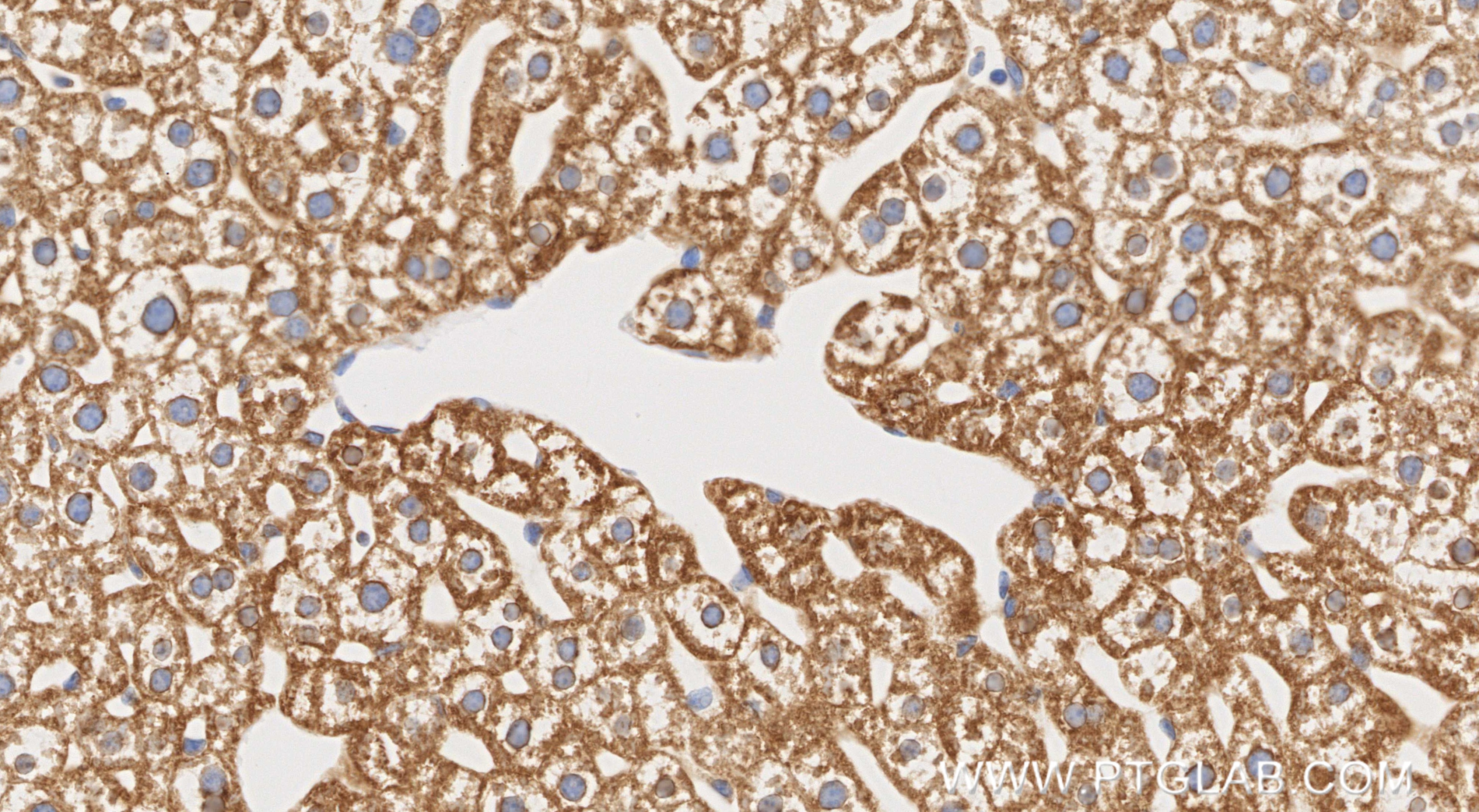 Immunohistochemistry (IHC) staining of mouse liver tissue using ALDH3A1 Recombinant monoclonal antibody (85725-1-RR)