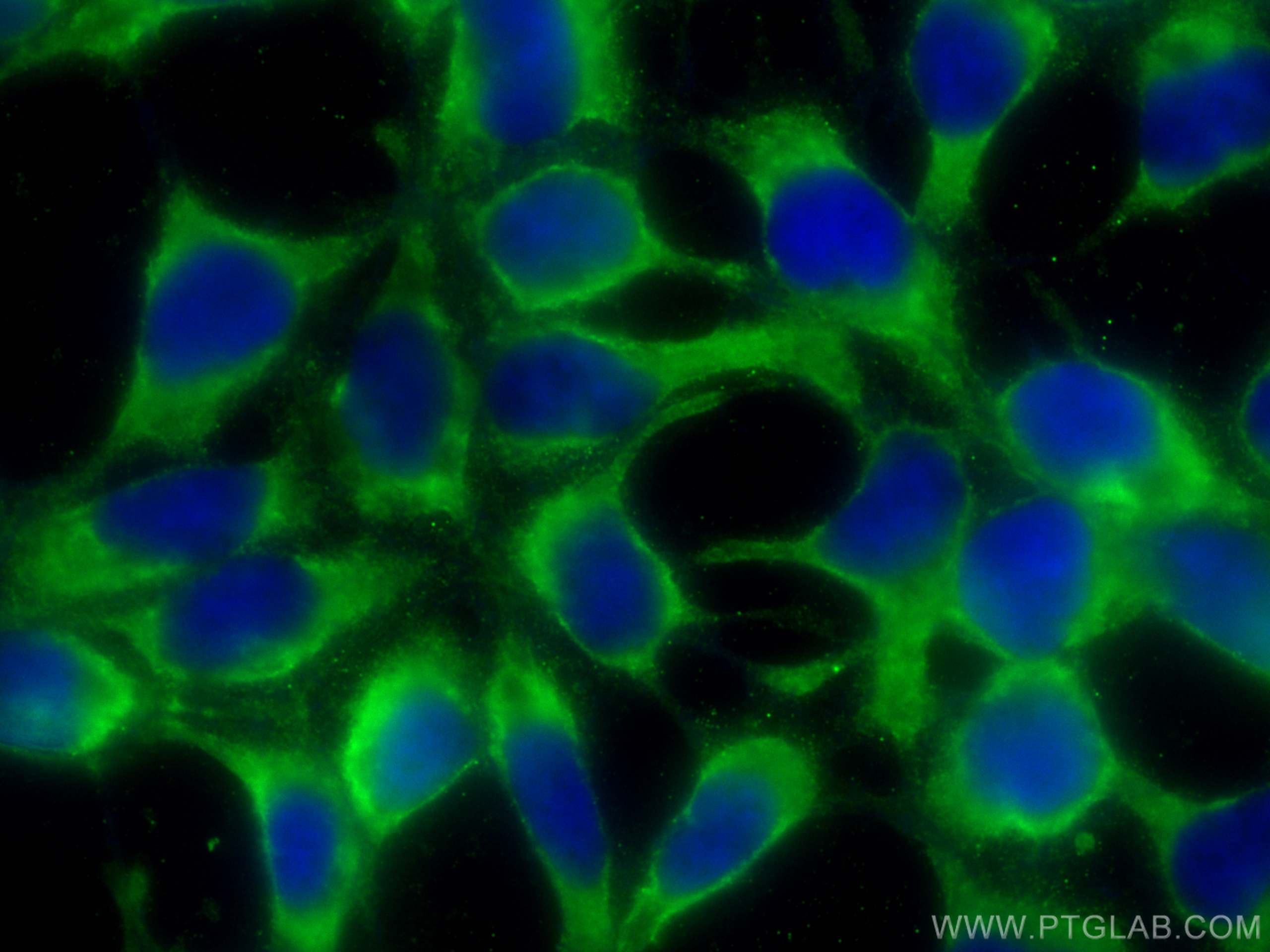 Immunofluorescence (IF) / fluorescent staining of HEK-293 cells using CoraLite® Plus 488-conjugated ALDH3A1 Polyclonal a (CL488-15578)