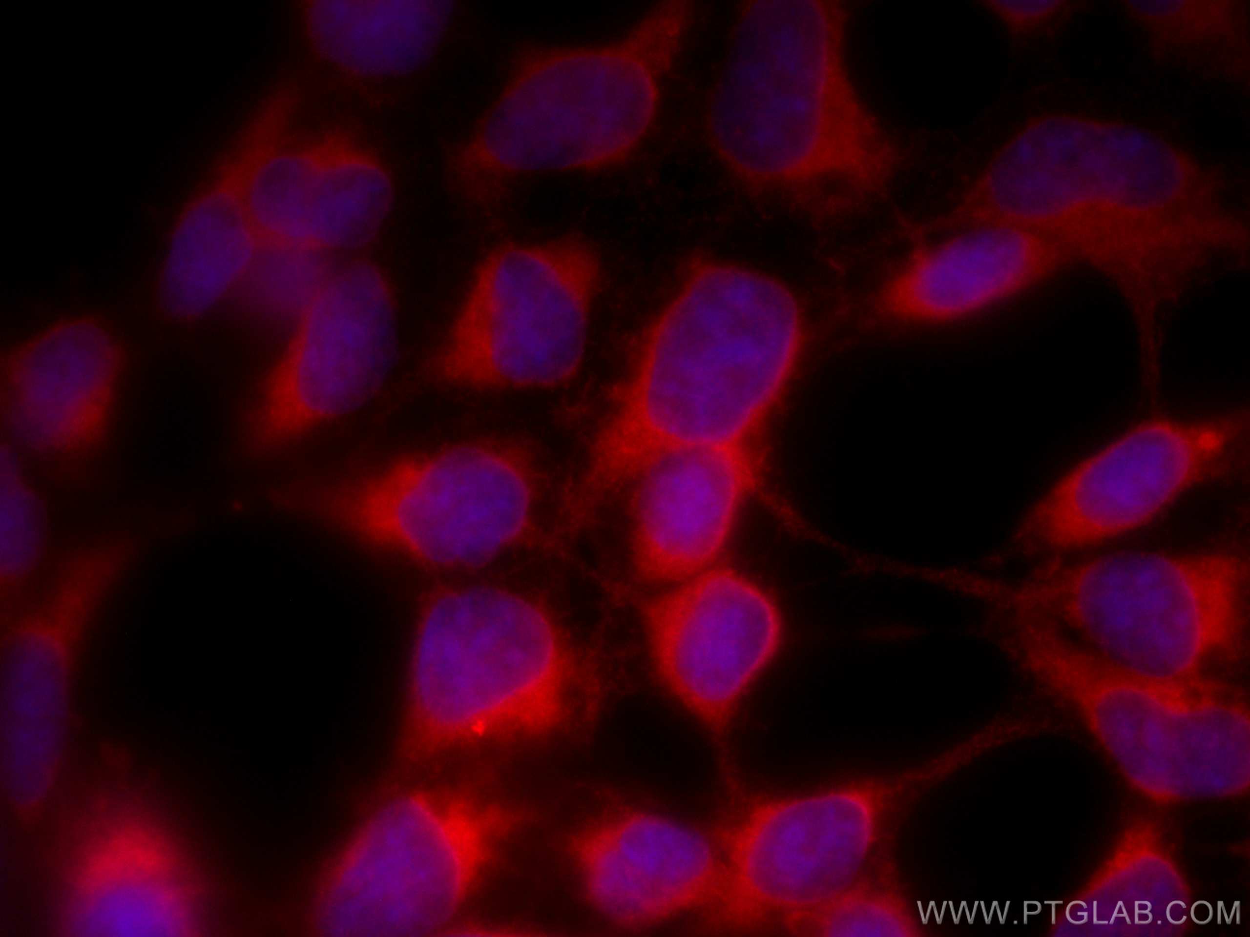 Immunofluorescence (IF) / fluorescent staining of HEK-293 cells using CoraLite®594-conjugated ALDH3A1 Monoclonal antibod (CL594-68036)