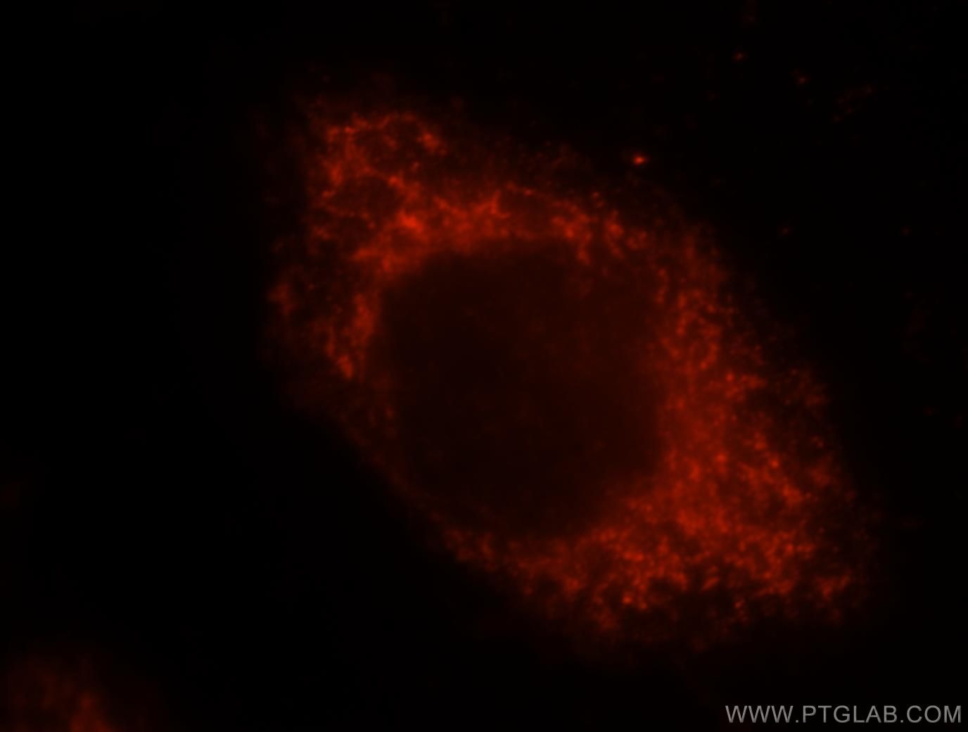 Immunofluorescence (IF) / fluorescent staining of HeLa cells using ALDH3A2 Polyclonal antibody (15090-1-AP)