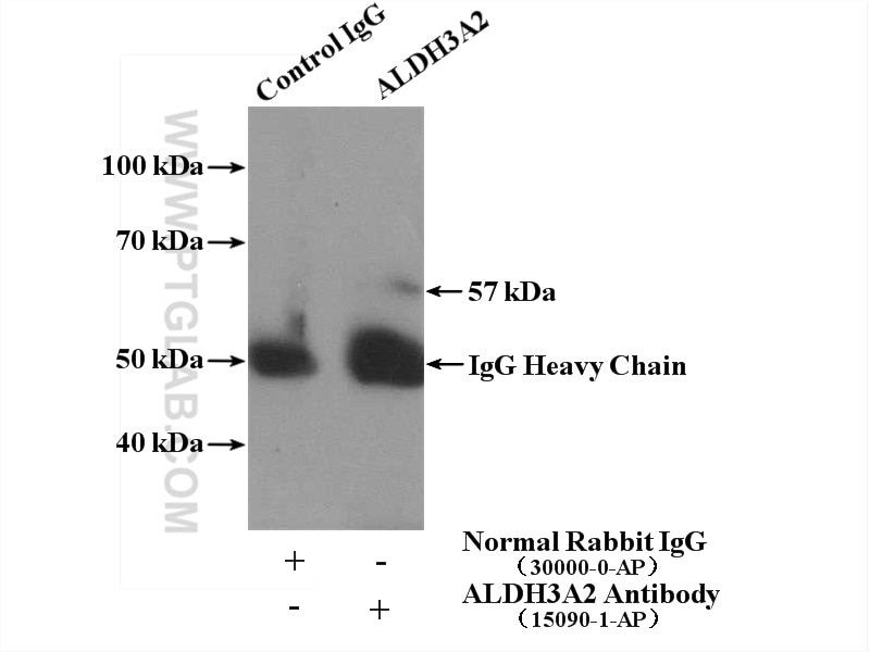 Immunoprecipitation (IP) experiment of HEK-293 cells using ALDH3A2 Polyclonal antibody (15090-1-AP)