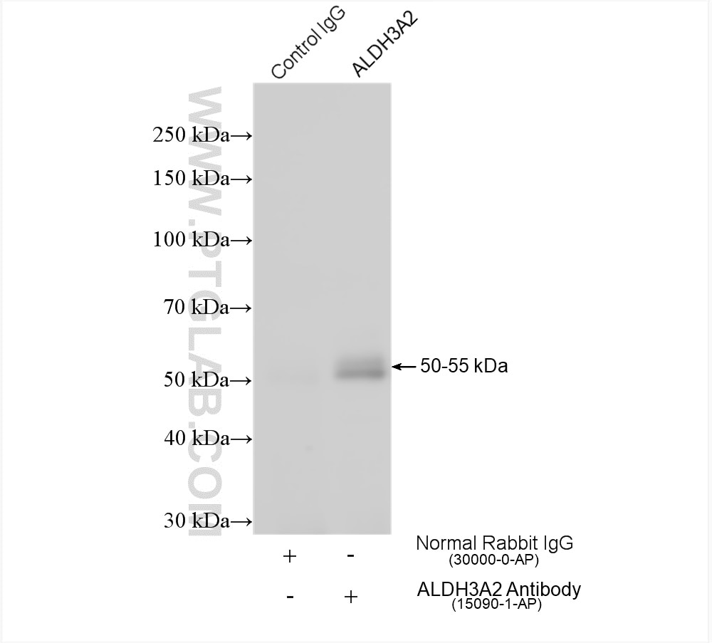 IP experiment of HEK-293 using 15090-1-AP