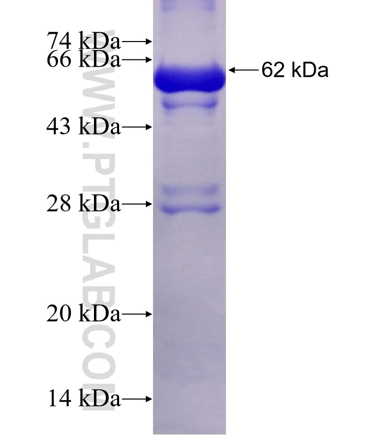 ALDH3A2 fusion protein Ag1687 SDS-PAGE