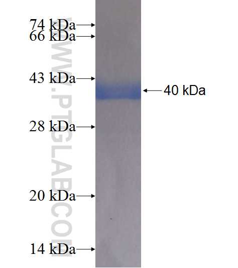 ALDH3A2 fusion protein Ag8753 SDS-PAGE