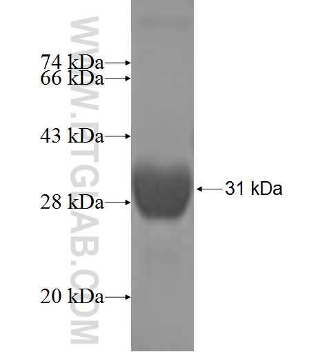 ALDH3B1 fusion protein Ag7025 SDS-PAGE