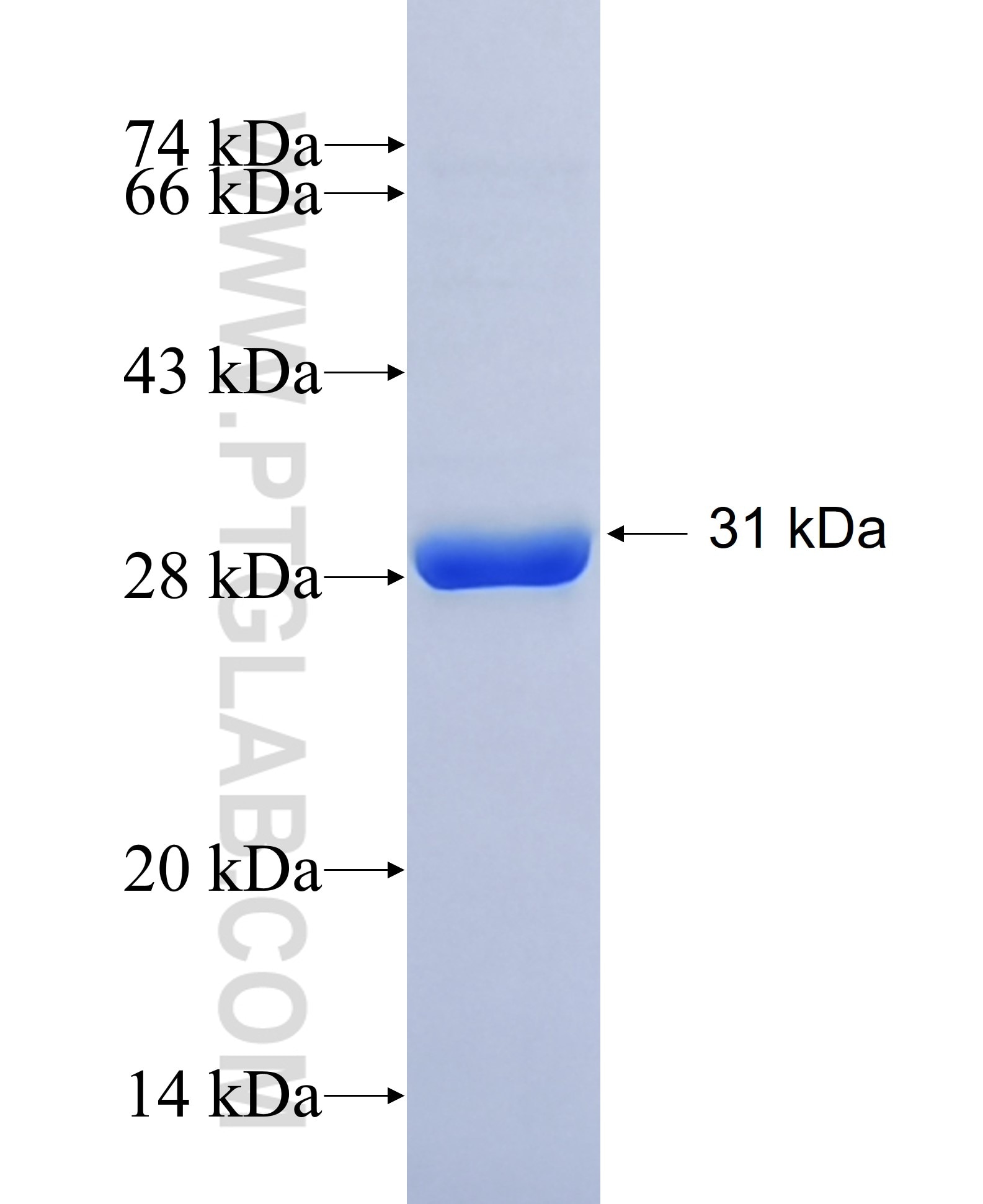 ALDH3B1 fusion protein Ag7025 SDS-PAGE