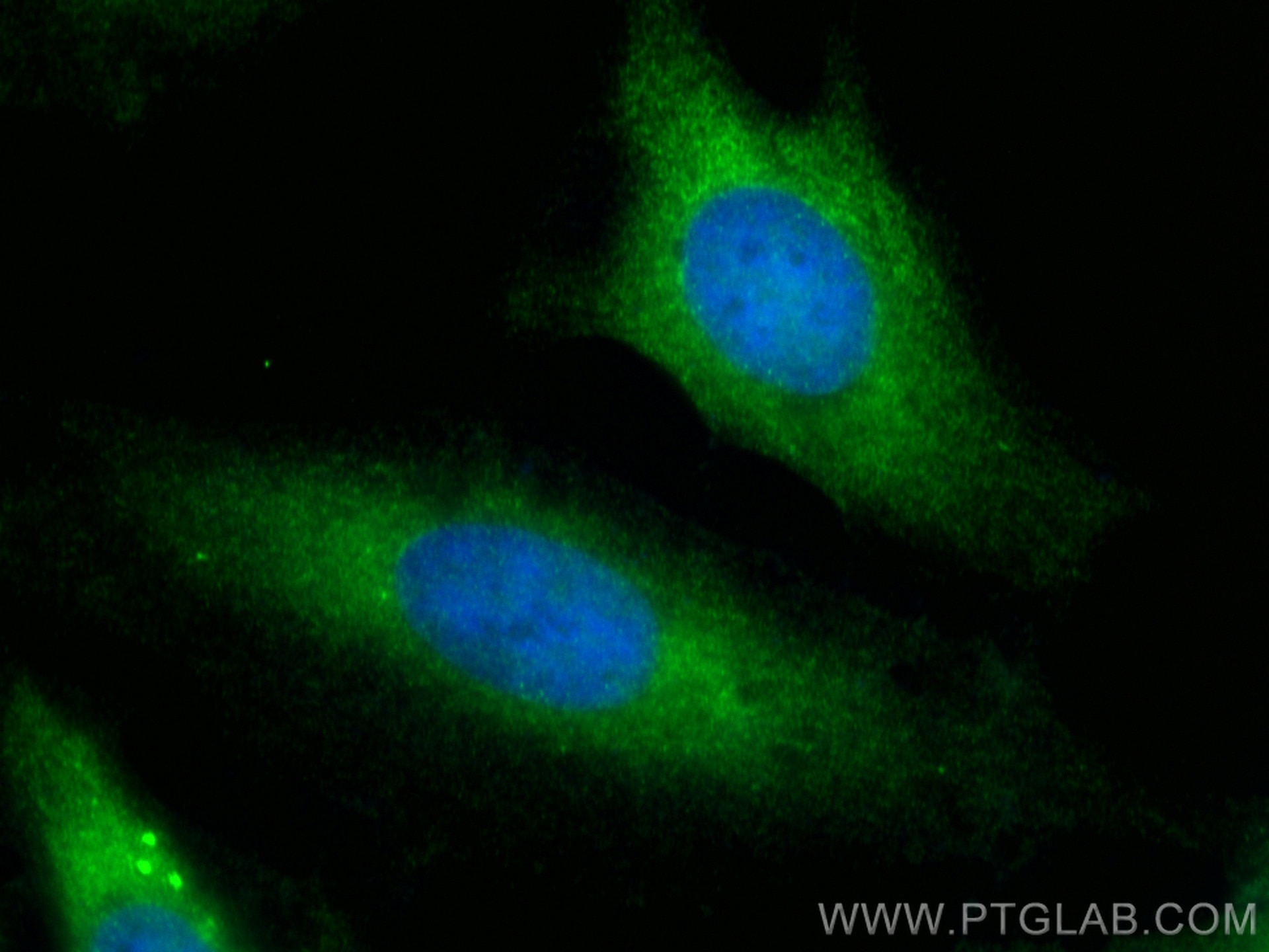 Immunofluorescence (IF) / fluorescent staining of HeLa cells using ALDH3B2 Polyclonal antibody (15746-1-AP)