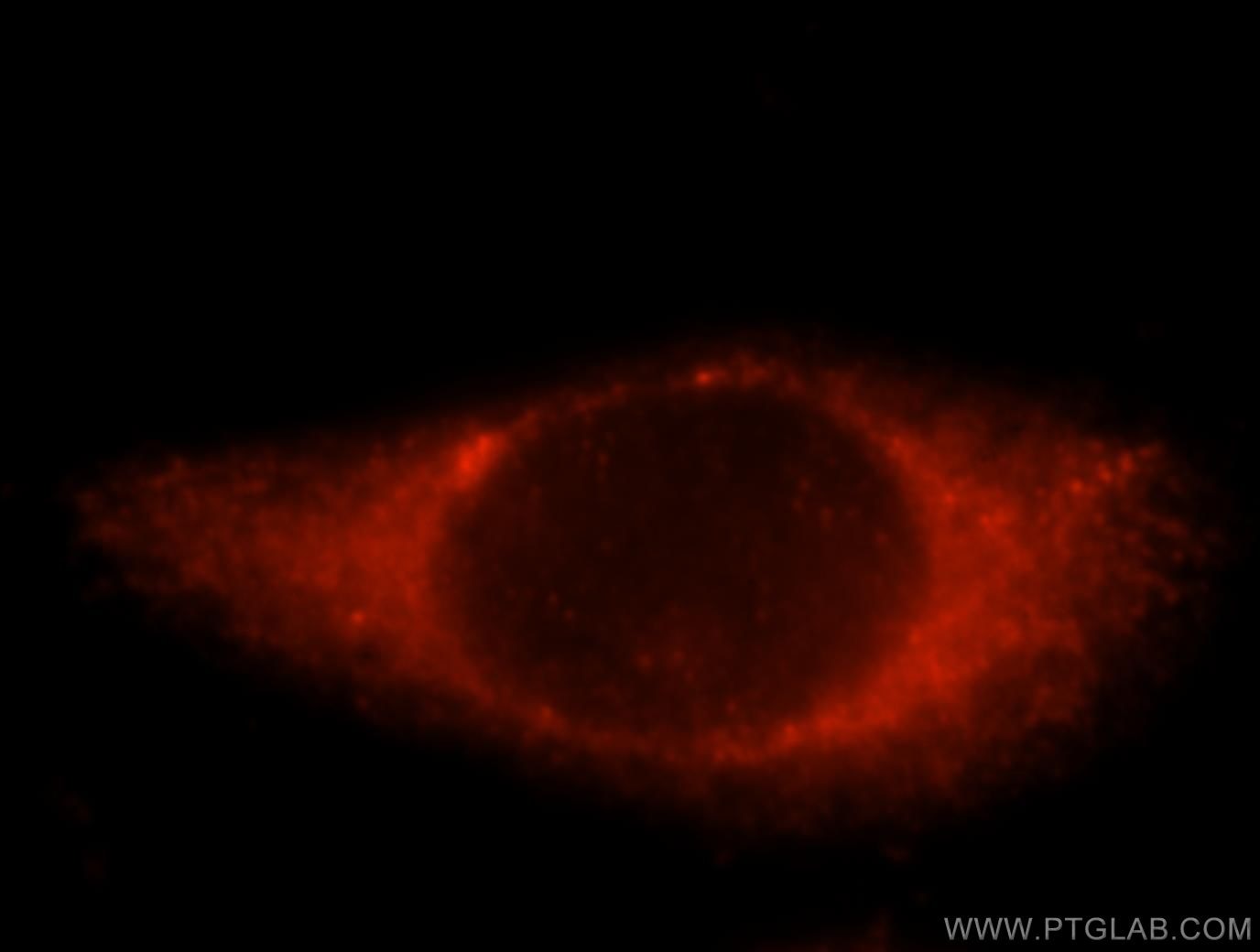 Immunofluorescence (IF) / fluorescent staining of HeLa cells using ALDH3B2 Polyclonal antibody (15746-1-AP)