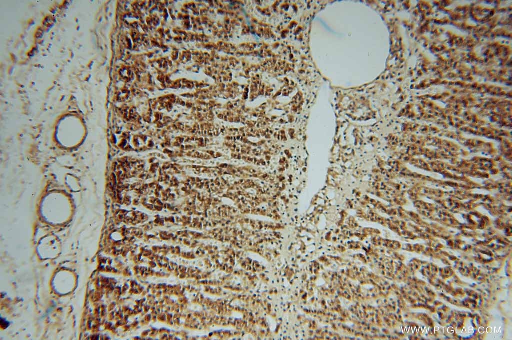 Immunohistochemistry (IHC) staining of human adrenal gland tissue using ALDH3B2 Polyclonal antibody (15746-1-AP)