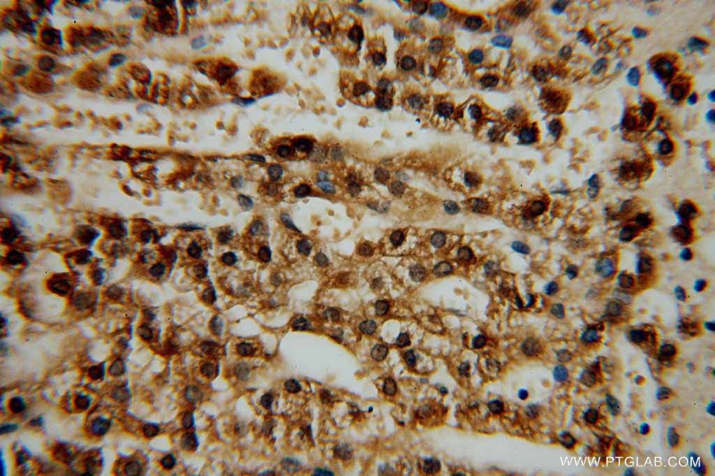 Immunohistochemistry (IHC) staining of human adrenal gland tissue using ALDH3B2 Polyclonal antibody (15746-1-AP)