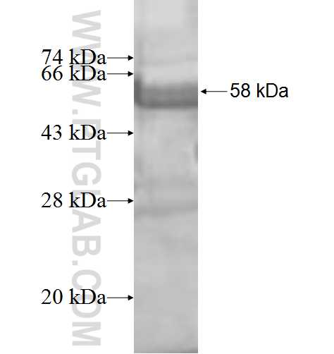 ALDH3B2 fusion protein Ag8175 SDS-PAGE