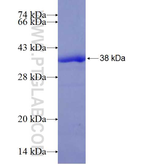 ALDH3B2 fusion protein Ag8197 SDS-PAGE