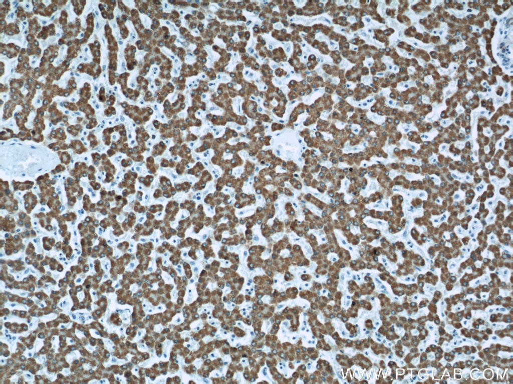 Immunohistochemistry (IHC) staining of human liver tissue using ALDH4A1 Polyclonal antibody (11604-1-AP)