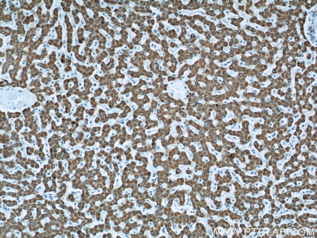 IHC staining of human liver using 11604-1-AP