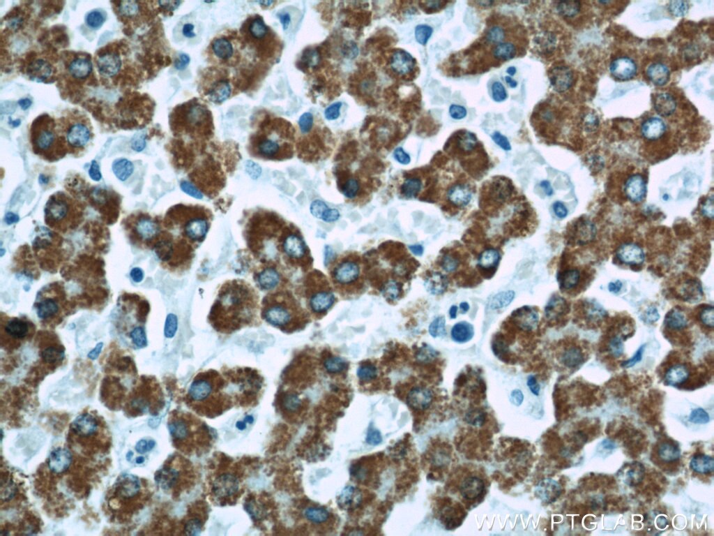 Immunohistochemistry (IHC) staining of human liver tissue using ALDH4A1 Polyclonal antibody (11604-1-AP)