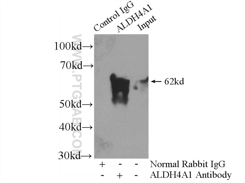 IP experiment of mouse skeletal muscle using 11604-1-AP