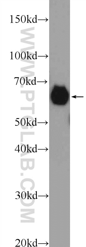 Western Blot (WB) analysis of rat heart tissue using ALDH4A1 Polyclonal antibody (11604-1-AP)