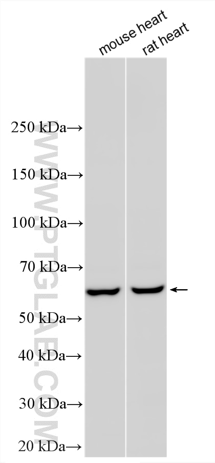 WB analysis using 11604-1-AP Western Blot (WB) analysis of various lysates using ALDH4A1 Polyclonal antibody (11604-1-AP)