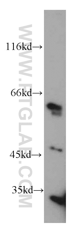 Western Blot (WB) analysis of K-562 cells using ALDH4A1 Polyclonal antibody (11604-1-AP)