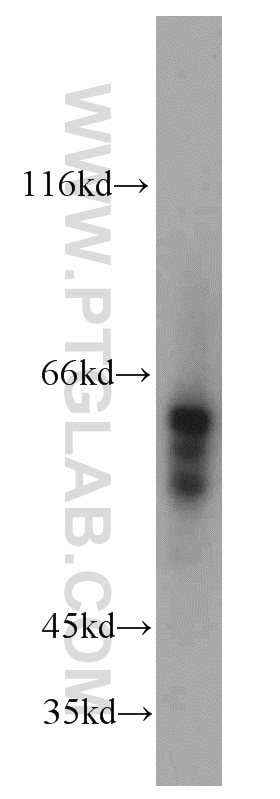 Western Blot (WB) analysis of human heart tissue using ALDH4A1 Polyclonal antibody (11604-1-AP)